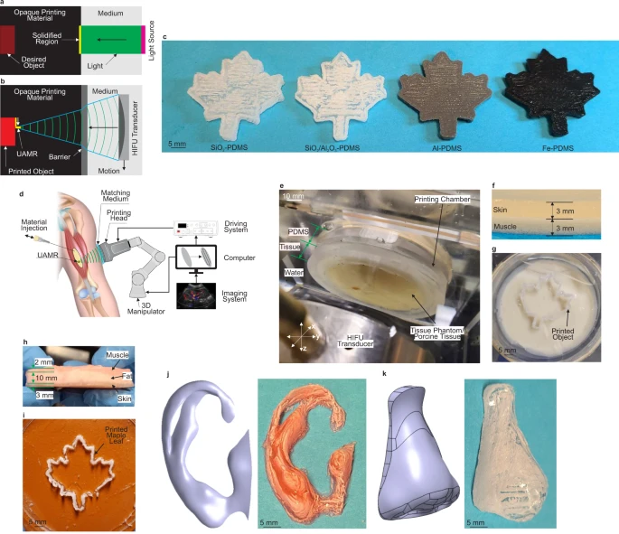 3D-печать звуковыми волнами (DSP) - будущее медицины