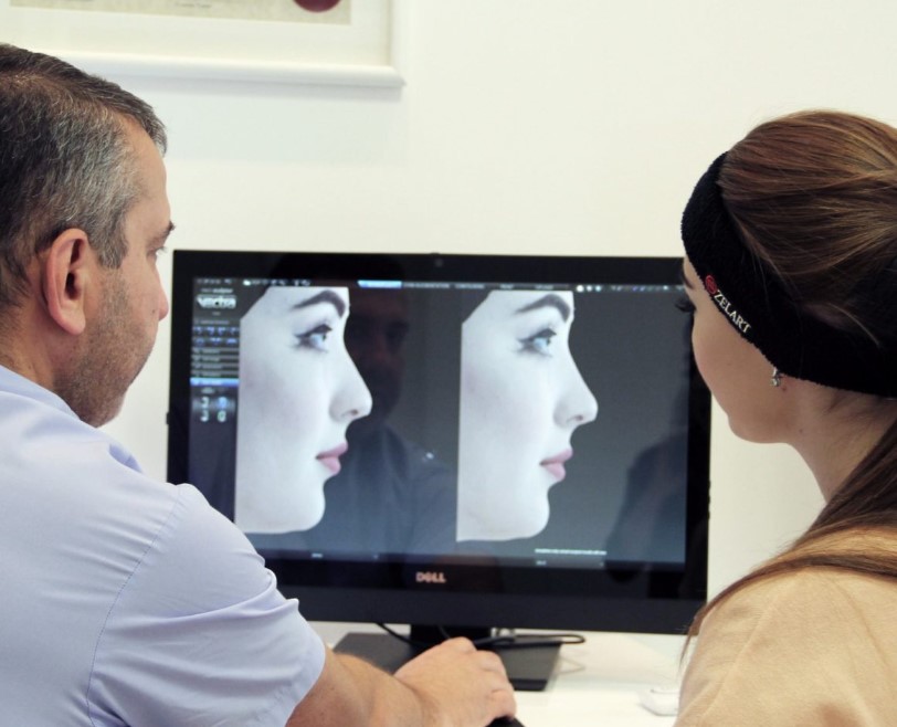 Ознакомление пациентки с предположительным результатом ринопластики на основе трехмерного изображения ее лица