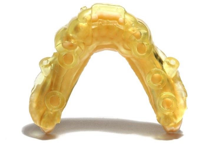 Накладка на десну из Dental Yellow Clear