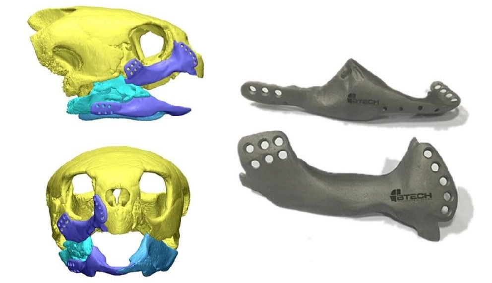 3D модель протеза для Акут слева и готовый протез справа