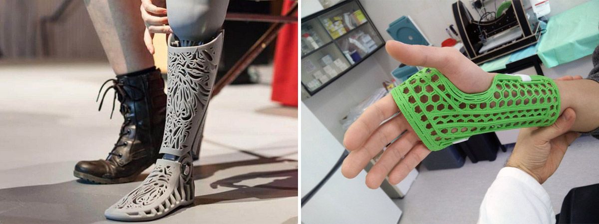 Применение 3D-печати: медицинские протезы