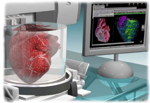 Трехмерная модель сердца, созданная на основе данных, полученных в результате сканирования