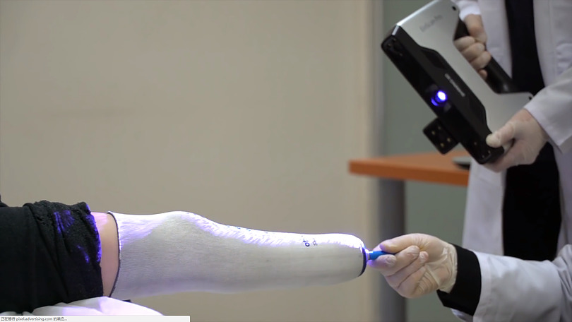 Использование лазерного 3D-сканера в трансплантологии 