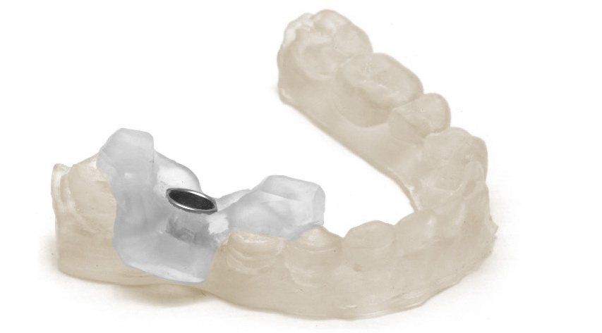 Кусок челюсти напечатанный из Harz Labs Dental Clear