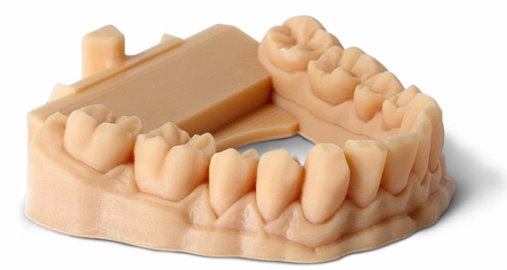 Модель из Phrozen Dental Model
