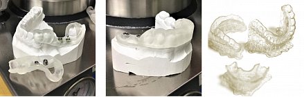 Фотополимерная смола HARZ Labs Dental Clear, прозрачный (1000 гр)